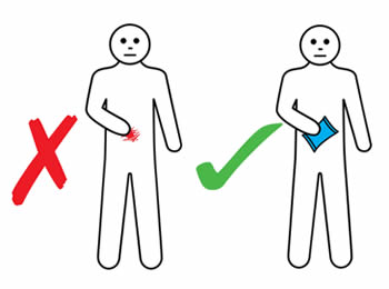 infusion site reaction action